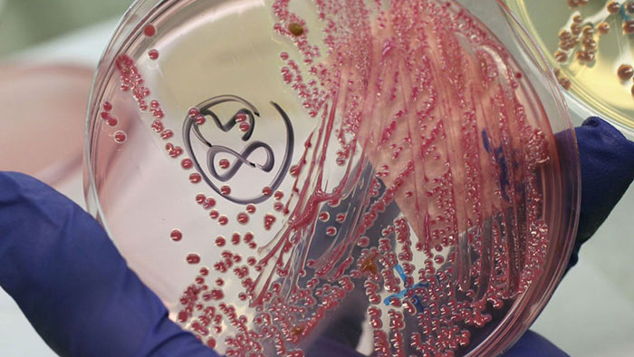 AI pomohla vytvořit Halicin, nové a velice slibné antibiotikum