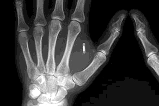 Firma ve Švédsku odstartovala čipování zaměstnanců