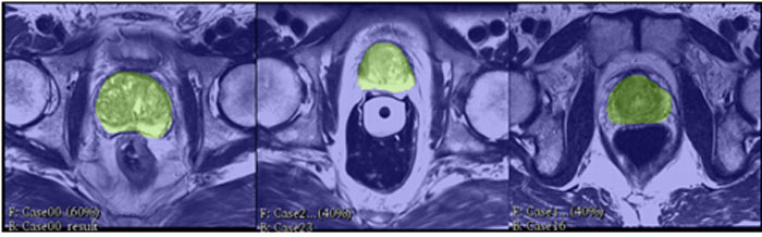 NVIDIA razí cestu do "nového světa inteligentních zdravotnických nástrojů"