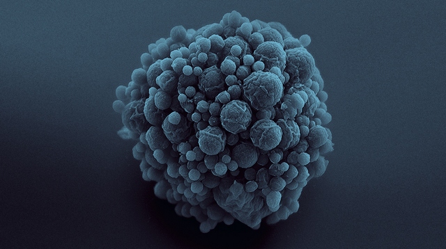 Vědci objevili reakci, která mohla spustit vývoj života