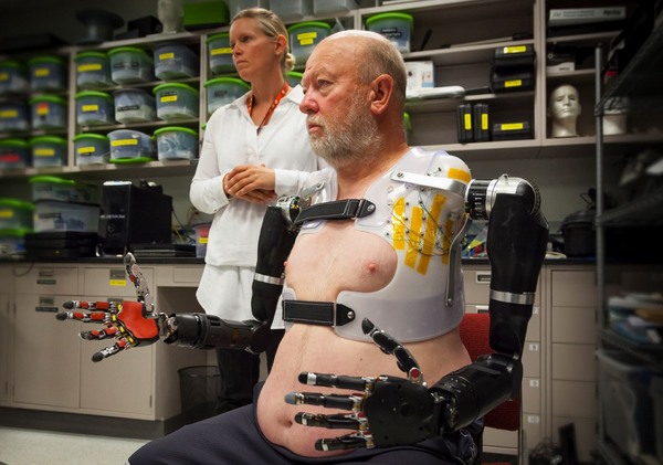 Průlom v bionice: pacienti používají umělé ruce jako své vlastní