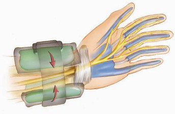 Počítače a zdravotní problémy