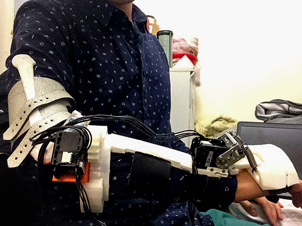 Exoskeleton pro nemocné, zastaví třes pacientů s Parkinsonem