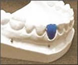 blue_tooth.jpg image