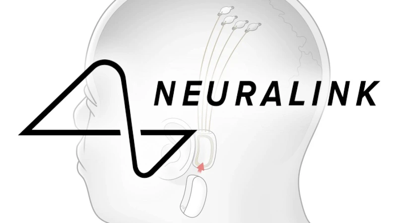 Muskův Neuralink provedl první implantaci svého čipu do mozku člověka