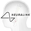Neuralink má nyní 2. pacienta pro mozkový implantát, vyřeší problémy z 1. pokusu